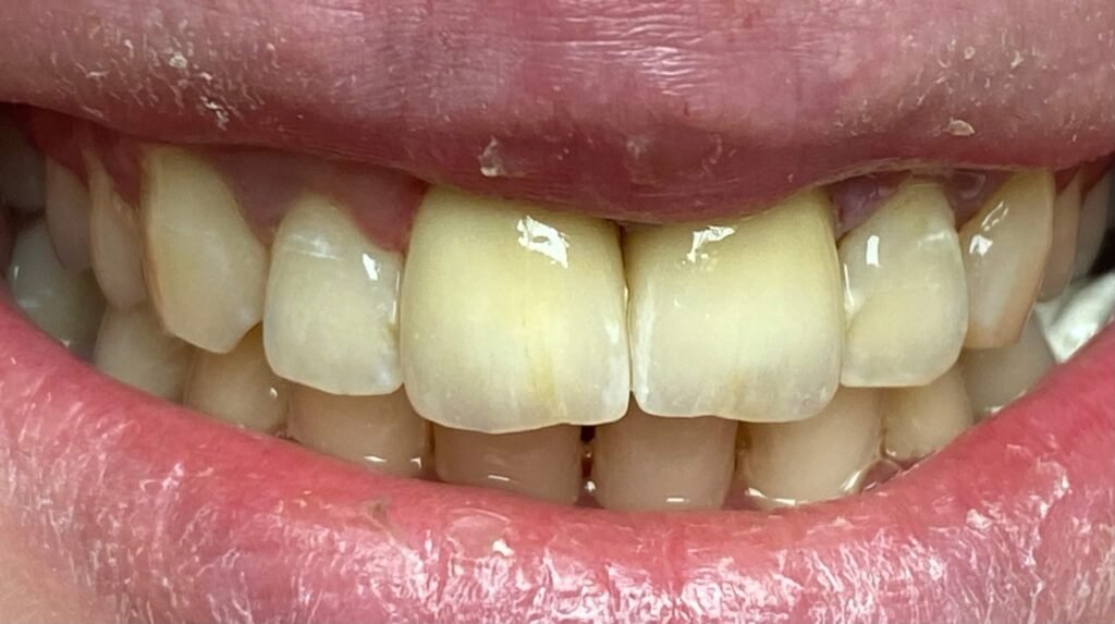 Komáromtól fél órára: fogászat saját laborral Győr belvárosában 4 Color Dent utana